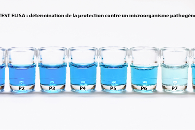 Test Elisa - résultats bruts